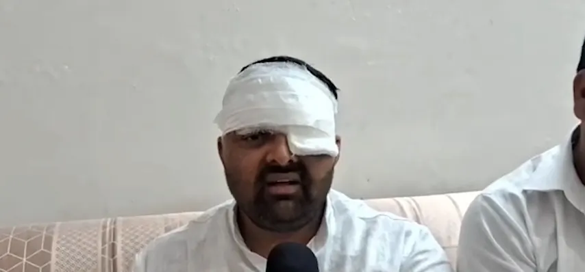 मेरठ: किसान नेता ने एसएसपी पर थर्ड-डिग्री टॉर्चर का लगाया आरोप, पुलिस ने आरोपों को किया खारिज