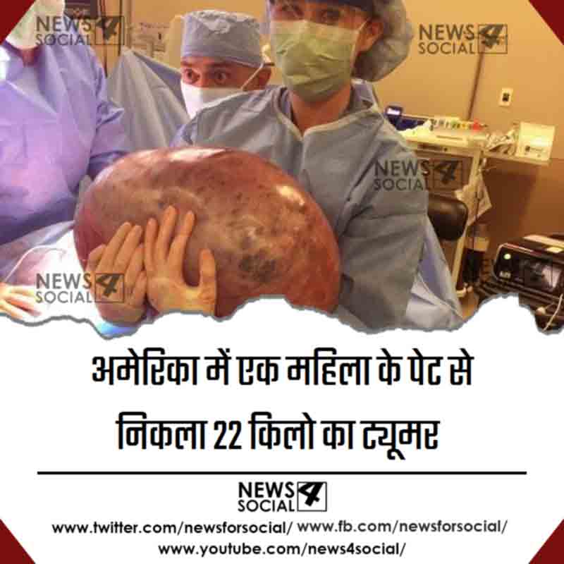 alabama-womans-50-pound-weight-gain-turns-out-to-be-massive-ovarian-cyst_news4social