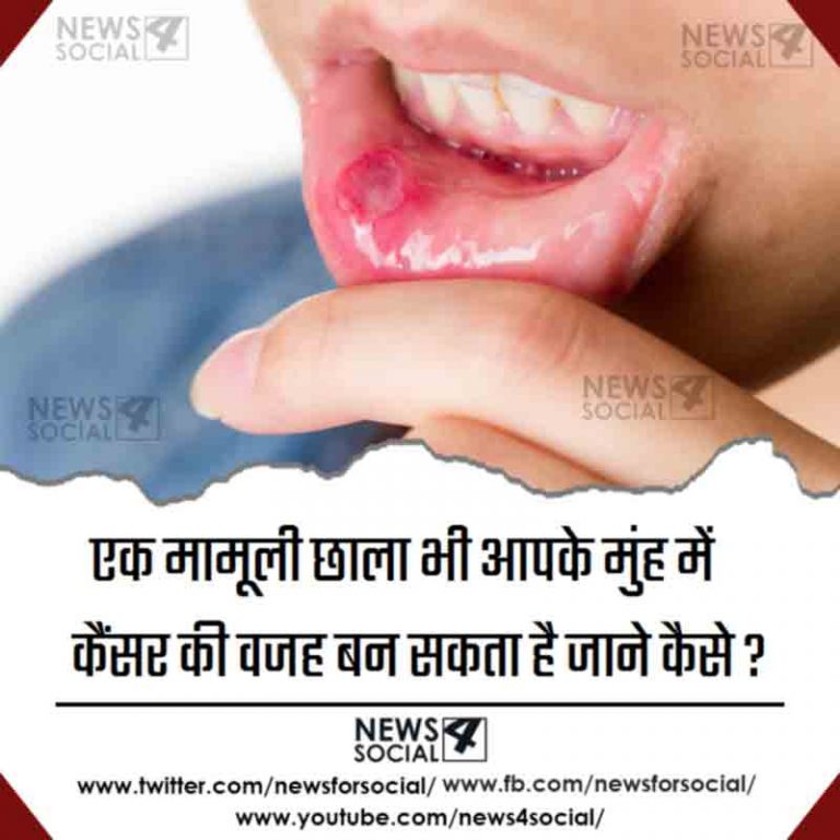 एक मामूली छाला भी आपके मुंह में कैंसर की वजह बन सकता है जाने कैसे?