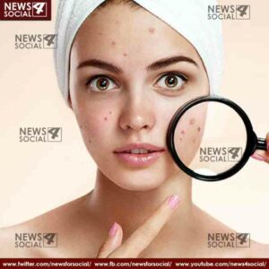 health benefits of clove 5