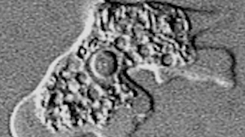 150831171251 brain eating amoeba cohen explainer orig mg 00011325 exlarge 169