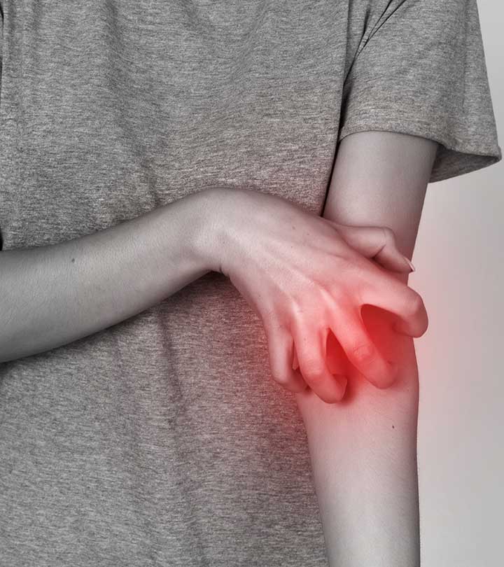 Scabies Causes Symptoms and Home Remedies in Hindi
