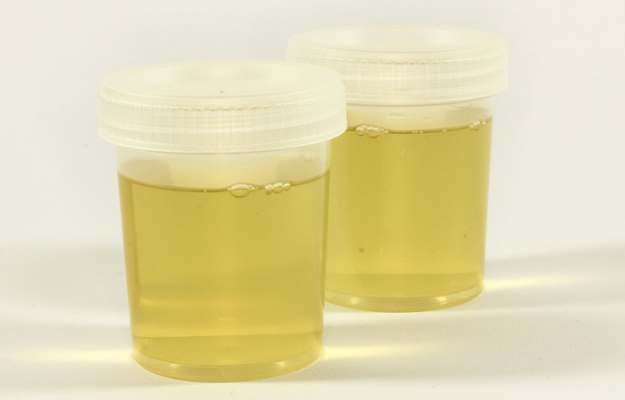 urine non fiiii