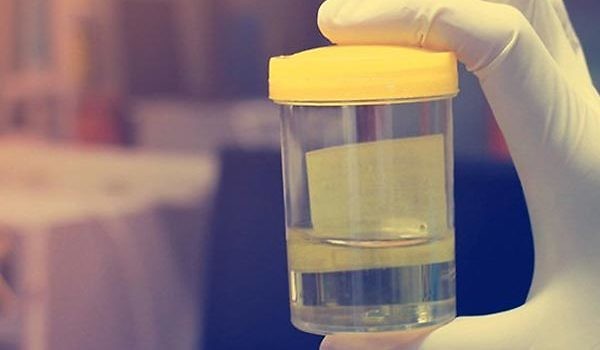 urine non