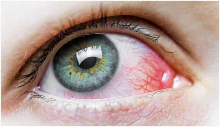 eyes2 1620546766 1