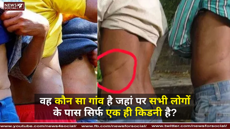 वह कौन सा गांव है जहां पर सभी लोगों के पास सिर्फ एक ही किडनी है?
