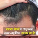गंजापन रोकने के लिए सबसे अच्छा आयुर्वेदिक उपचार क्या है?