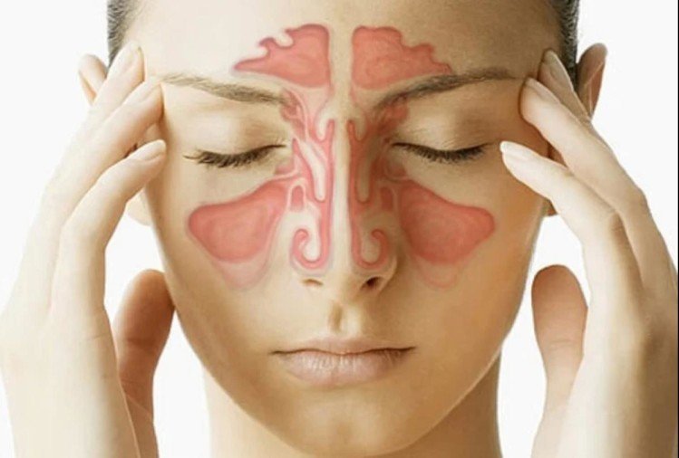sinus non