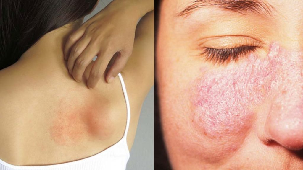 Home Remedies for Skin Alle 1280x720 1