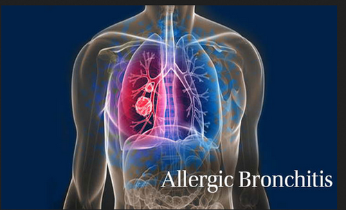 allergic bronchitis treatment 500x500 1