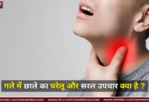 गले में छाले का घरेलू और सरल उपचार क्या है ? गले में छाले का घरेलू और सरल उपचार क्या है ?