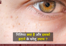 मिलिया क्या है और इसको हटाने के घरेलू उपाय ? मिलिया क्या है और इसको हटाने के घरेलू उपाय ?