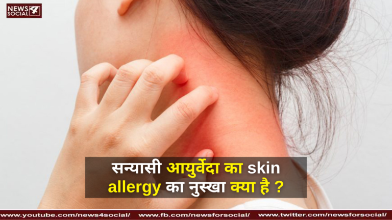 सन्यासी आयुर्वेदा का skin allergy का नुस्खा क्या है