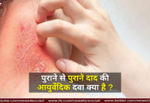 पुराने से पुराने दाद की आयुर्वेदिक दवा क्या है ? पुराने से पुराने दाद की आयुर्वेदिक दवा क्या है