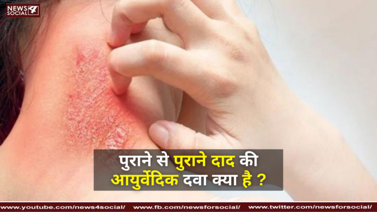 पुराने से पुराने दाद की आयुर्वेदिक दवा क्या है