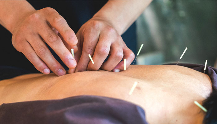 acupuncture therapy in hindi 2
