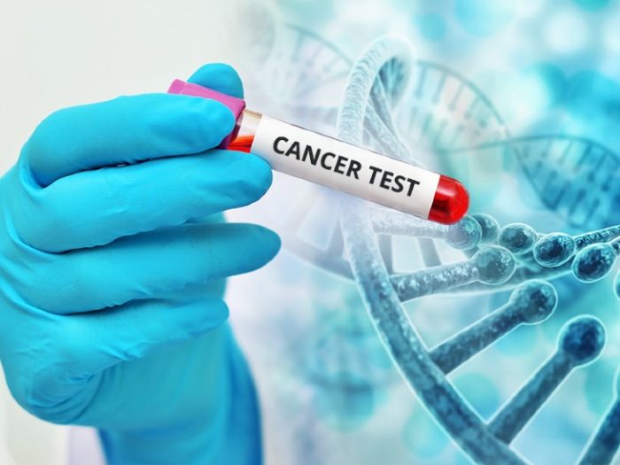 cancer test 1617098282
