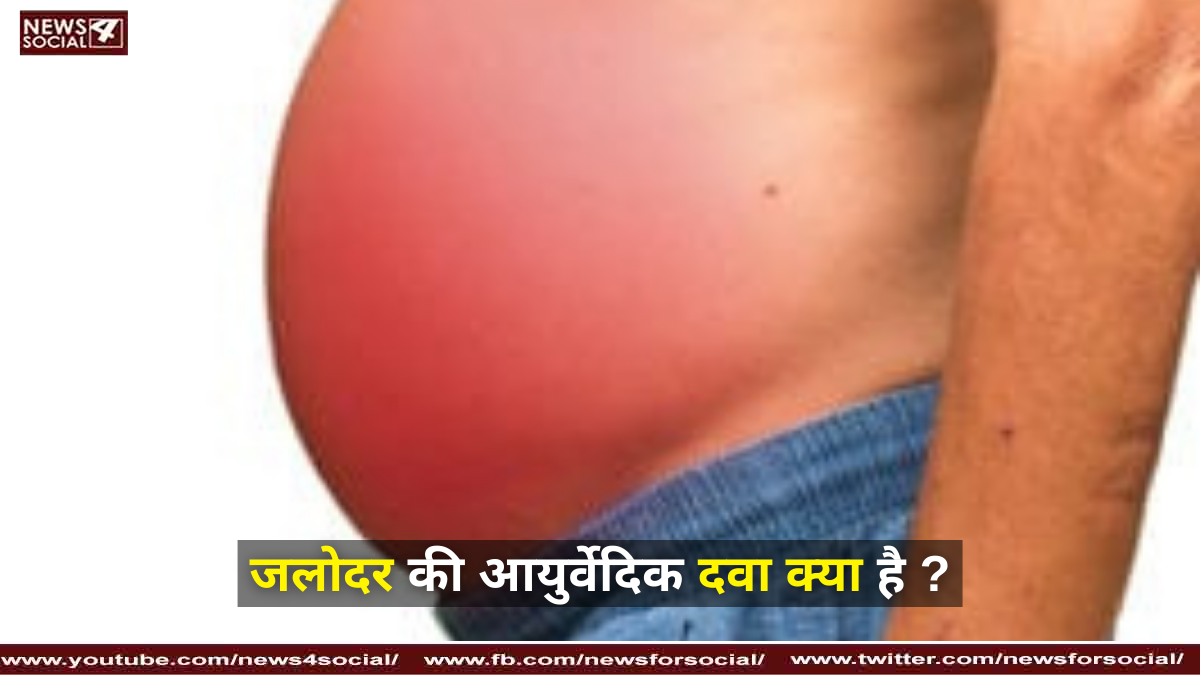 जलोदर की आयुर्वेदिक दवा क्या है ?