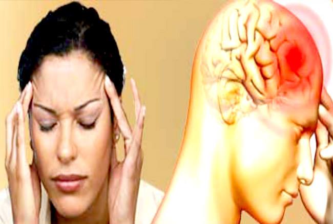 migraine headache 2018050716360766