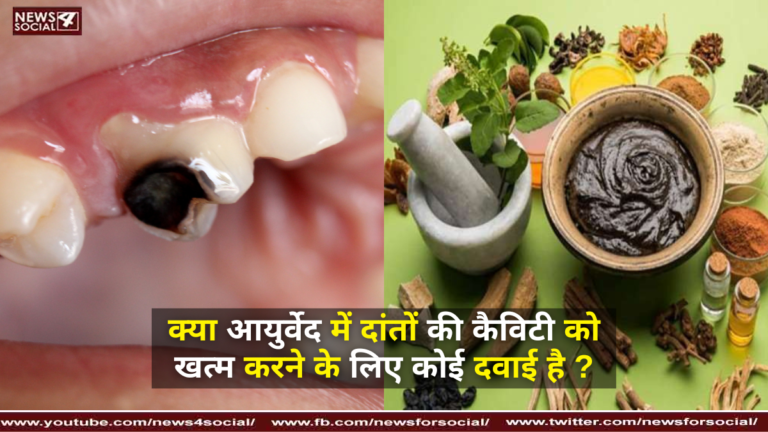 क्या आयुर्वेद में दांतों की कैविटी को खत्म करने के लिए कोई दवाई है ?