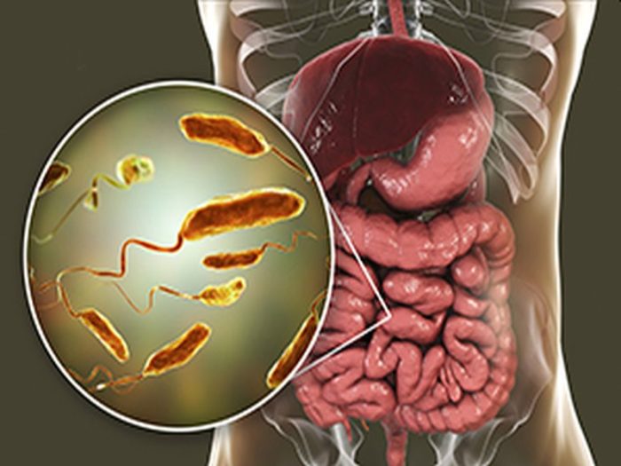 colera home remedies 202103204946