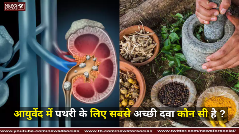 आयुर्वेद में पथरी के लिए सबसे अच्छी दवा कौन सी है ? ( Which is the best medicine for stone in ayurveda? )