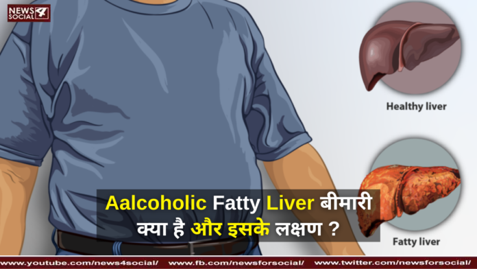 Aalcoholic Fatty Liver बीमारी क्या है और इसके लक्षण ? ( What is Aalcoholic Fatty Liver disease and its symptoms? )