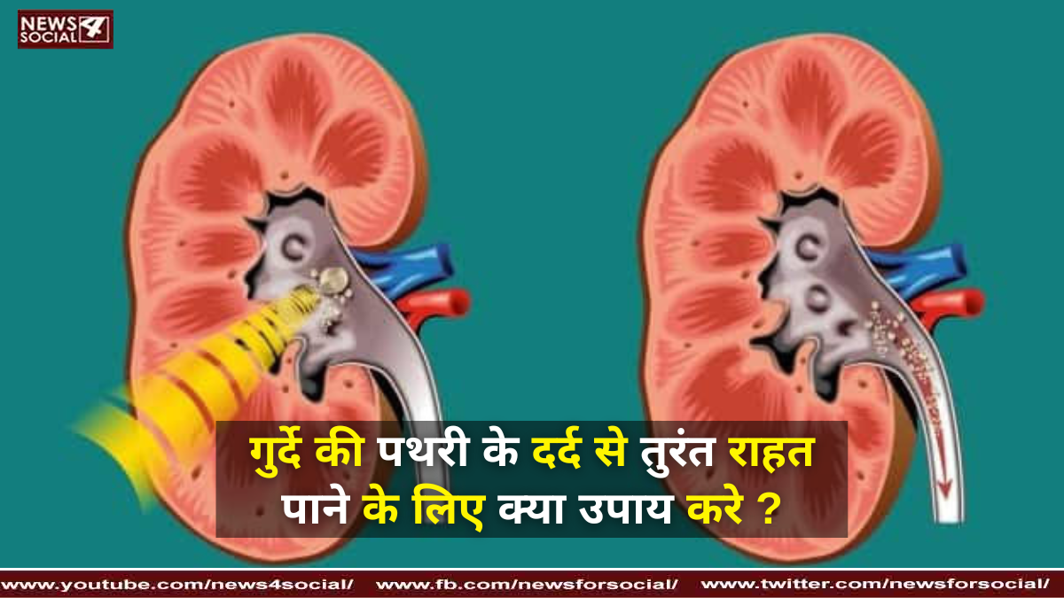 गुर्दे की पथरी के दर्द से तुरंत राहत पाने के लिए क्या उपाय करे ?