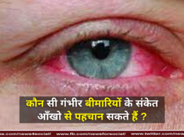 कौन सी गंभीर बीमारियों के संकेत आँखो से पहचान सकते हैं ? ( Signs of which serious diseases can be recognized by the eyes? )